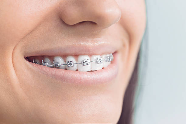 Best Dental Implants  in Belton, TX